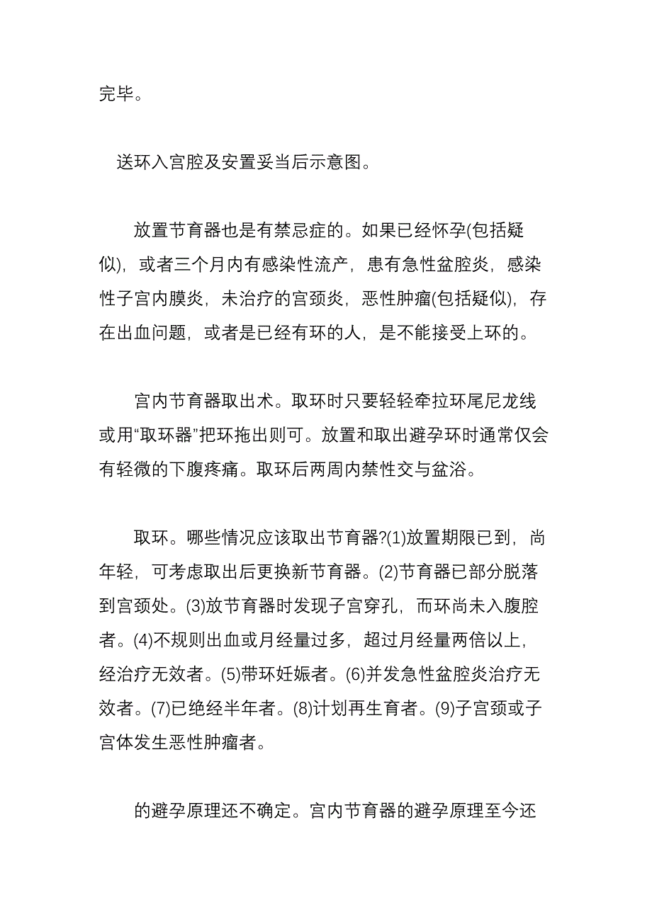 高清图解女性上环全过程