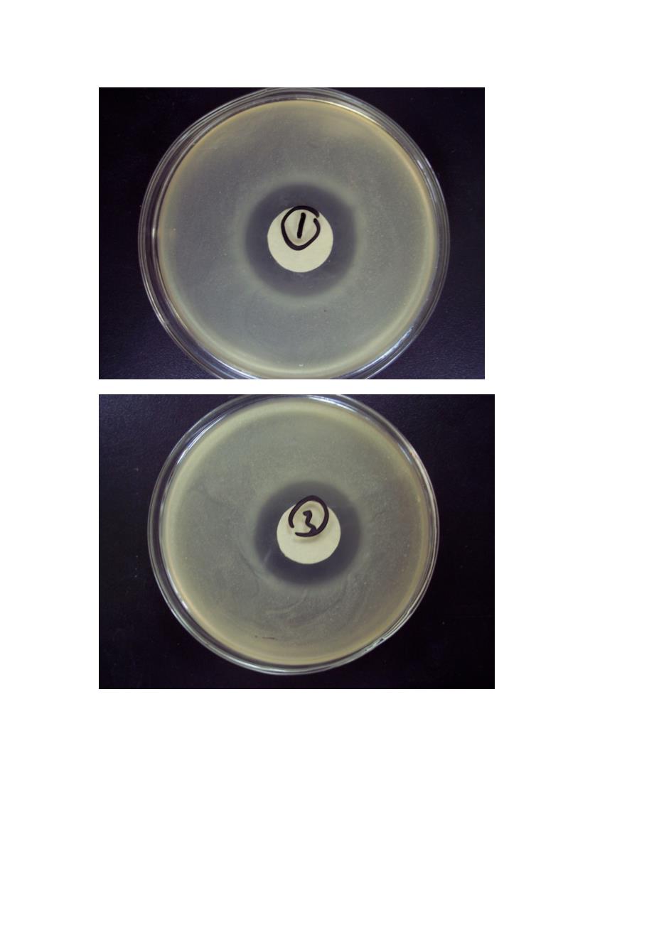 抗菌实验—抑菌圈法