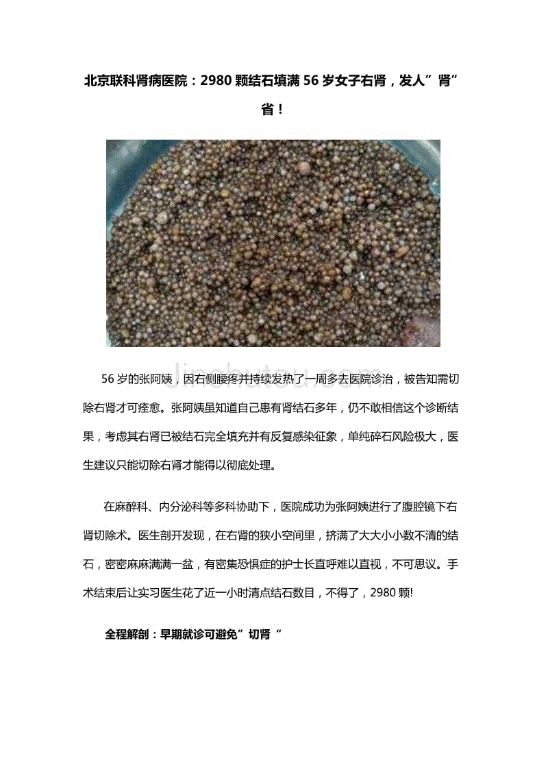 北京联科中医肾病医院：2980颗结石填满56岁女子右肾，发人”肾”省！